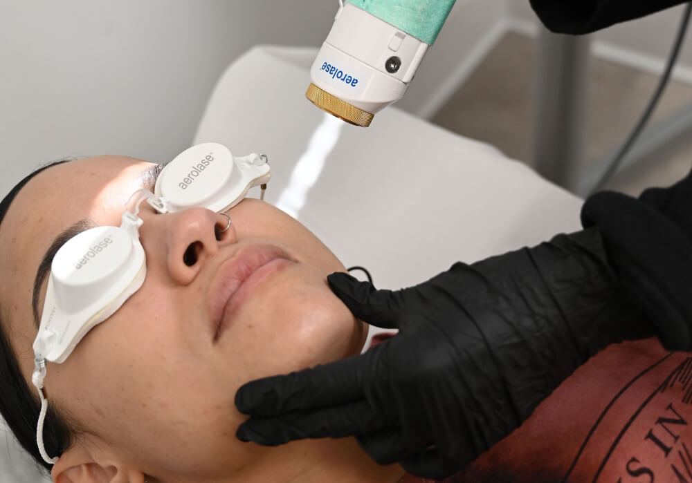 Aerolase Laser image