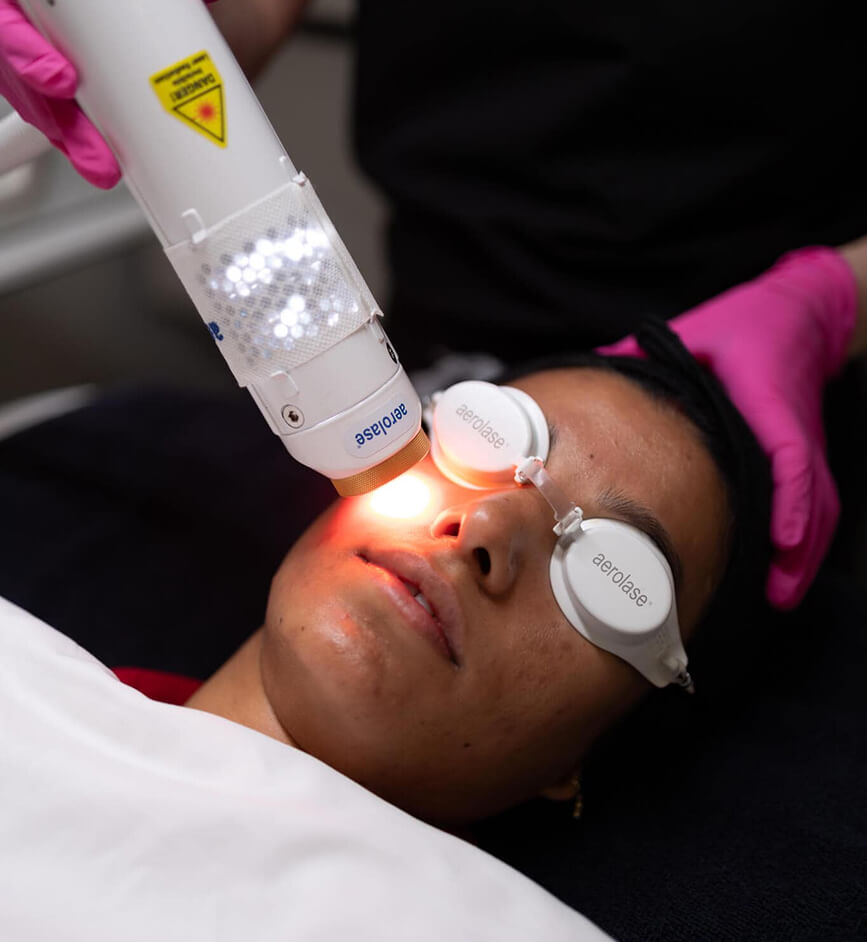 Aerolase Laser image