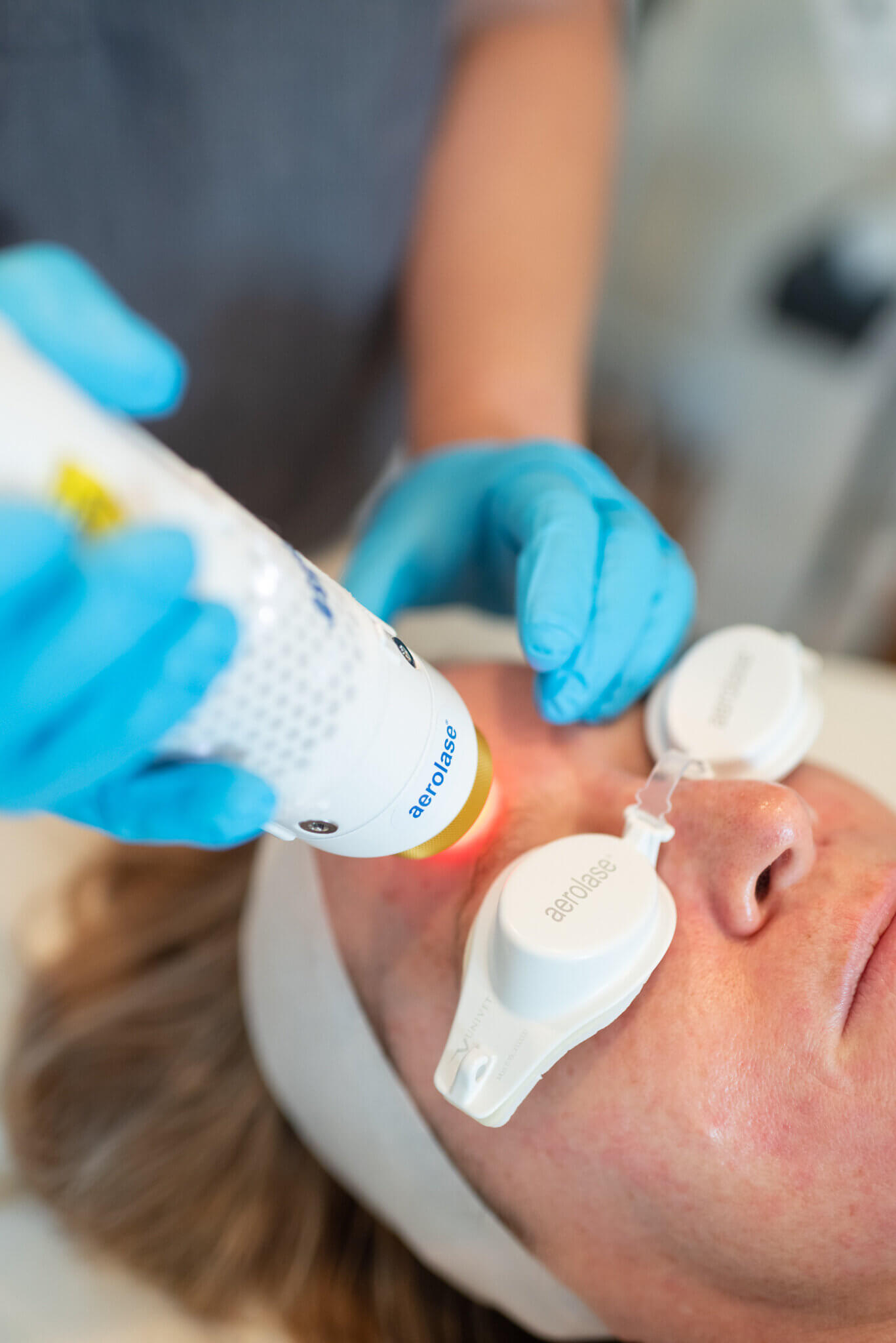 aerolase neo elite maryland