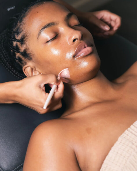 Chemical Peels - women image