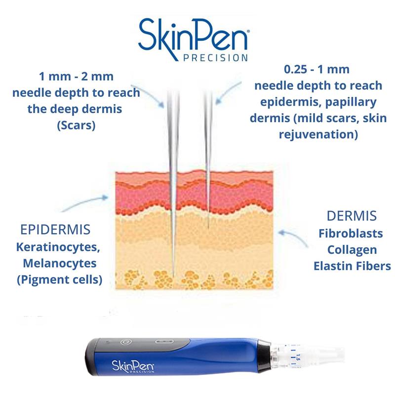 HOW SKINPEN MICRONEEDLING WORKS