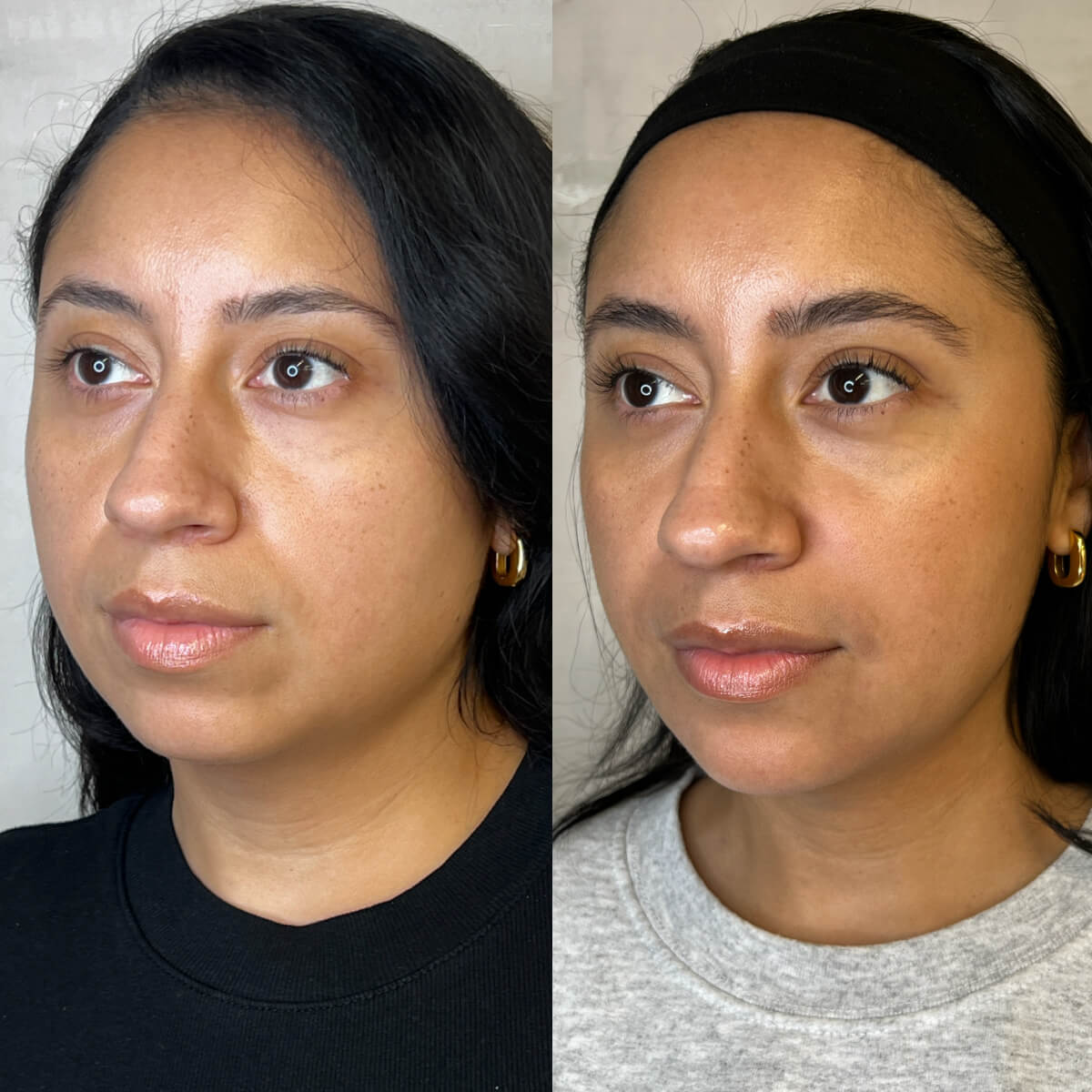 Luminaire Medical Work image - 1