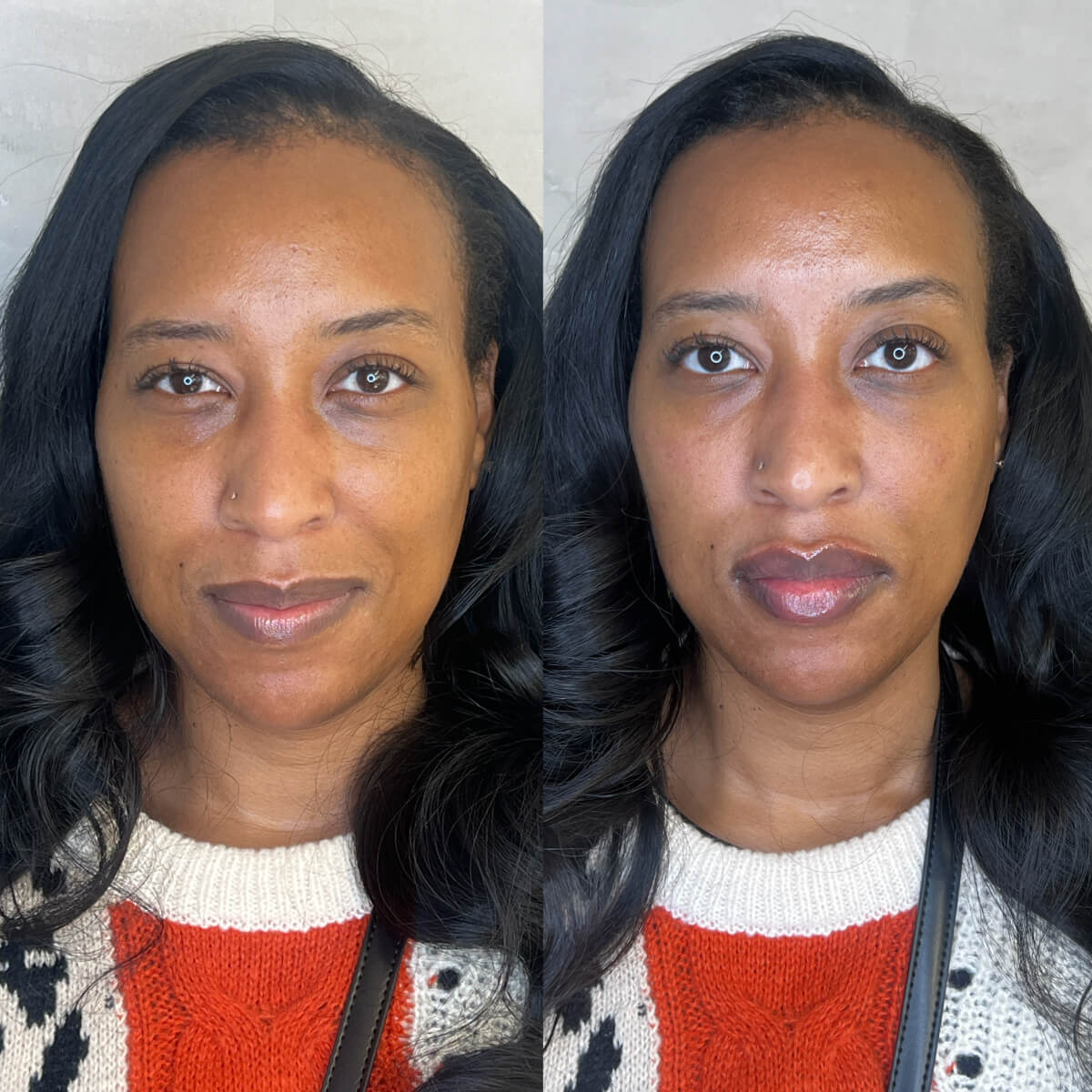 Luminaire Medical Work image - 3