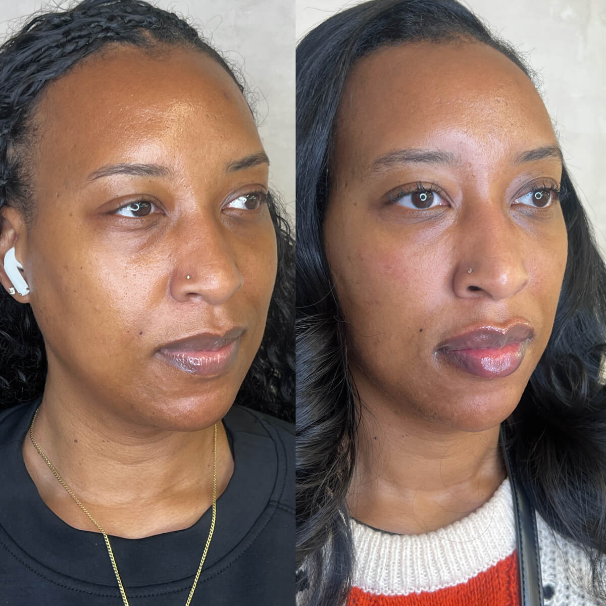 Luminaire Medical Work image - 4